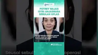 Disebut Hasilnya Natural, Intip Potret Dian Nitami seusai Sebulan Operasi Plastik, Tampak Awet Muda