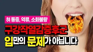 혀 통증, 구강작열감증후군, 혀가 아프고 가슴에서 목까지 신물이 올라와요. 20년 동안 구강작열감과 역류로 고통받던 60대 환자의 극적 변화 ㅣ 노기환 병원장