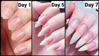 How to Grow Nails in 7 Days || one week nail Growth challange || How to grow Nails Fast ||
