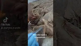 Los músculos supraespinoso e infraespinoso del manguito rotador