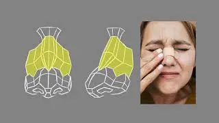 Why Your Nose Drawings Suck - Nose Drawing Course (1/8)