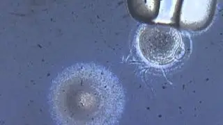 Sperm And Egg Footage