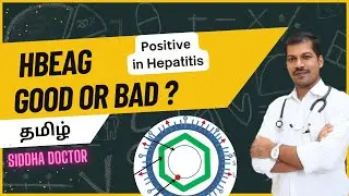 HBeAg Positive ? Good or bad in Hepatitis ? Tamil