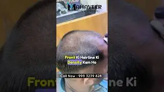 Hair Patch Service | Hair Patch ke Side effects | Hair Patch in Raipur Bilaspur 