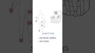 Osteoarthritis Explained #jointpain #arthritis #healthsketch