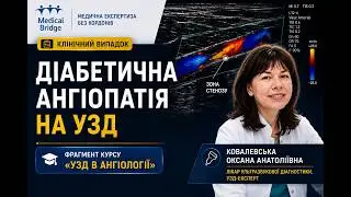 Фрагмент онлайн занятия УЗД сосудов нижних конечностей после хирургических вмешательств