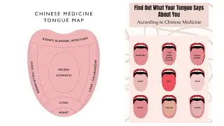 TONGUE INSPECTION IN CHINESE MEDICINE