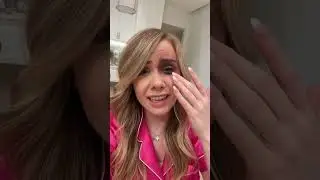 MY BEST FRIEND PUNCHED ME IN THE FACE...