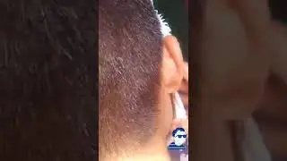 se le queda la máscara de yeso en la piel