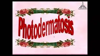 Photodermatosis-1