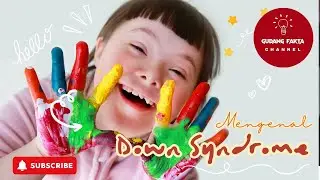 Mengenal Down Syndrom #infounik #infomenarik #unikmenarik #downsyndrom