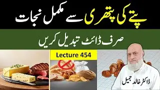 Stop Gallstones Fast: Easy Diet Tips You Need! | lecture 454