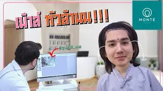 ใครหัวเถิกต้องดู!! เม้าส์พาไปปลูกผม [mousenatcha]