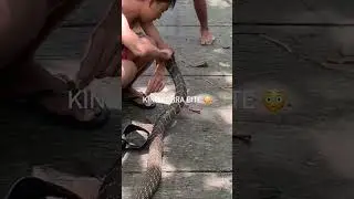 King cobra bite 