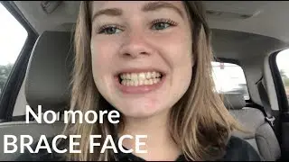 Getting My Braces Off Vlog!