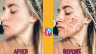 Skin Retouching Your Photo In PicsArt | PicsArt Tutorial