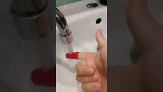 Последствия от укуса гуся 