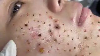 تلميع وتنظيف الجلد الطبيعي المدور 141307