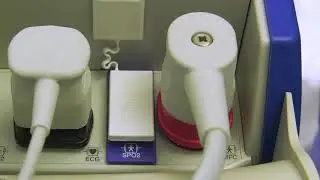 R Series Pacing - v14