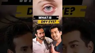 Dry Eyes, Different Causes