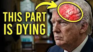 REAL DOCTOR: Trump's brain is failing (and it's only going to get worse from here)