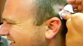 Scalp Capsule?  Wound #*(@#ing Material?