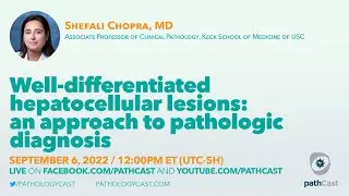 #LIVERPATH