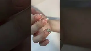 Очень боюсь стоматологов и дорога домой после каждого приема сопровождалась слезами хаха #shorts