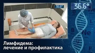 Лимфидема: лечение и профилактика