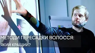 ПЛЮСИ І МІНУСИ МЕТОДІВ ТРАНСПЛАНТАЦІЇ ВОЛОССЯ