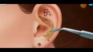 ear clean