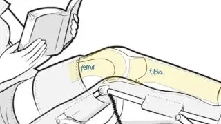 The joint capsule