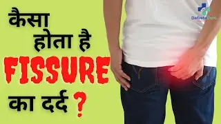 Anal fissure | Symptoms | anal fissure surgery 