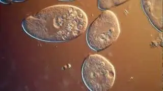 Love in the Afternoon! Conjugation in Ciliated Protozoa! Extreme HD!