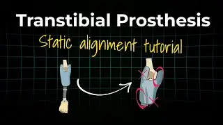 How to: Static Alignment of a Transtibial Prosthesis | Tutorial!