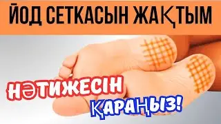Йод СЕТКАСЫН не үшін жағады?