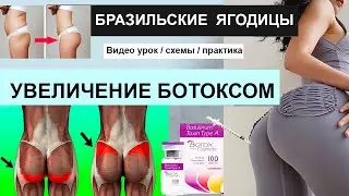 Ботокс 