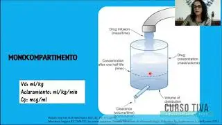 Anestesia total Intravenosa con TCI ¿Tecnología Madura?