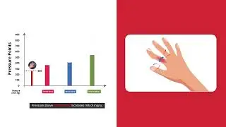Animated video for T Ring