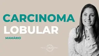 Carcinoma lobular da mama - câncer de mama