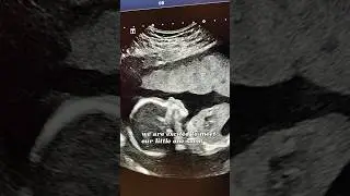 A wonderful blessing 🥰