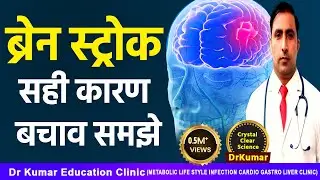 Brain Stroke in Hindi | ब्रेन स्ट्रोक- लक्षण बचाव और इलाज | Dr. Kumar Education