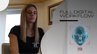 EASY FACE SCAN - Full Digital Workflow