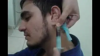 Drenando a Orelha de Jiu Jitsu