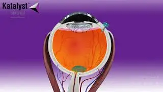 3D Medical Device Animation - Micro Vacuum Pick