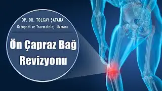 Recurrent Ön Çapraz Bağ Revizyon Ameliyatı