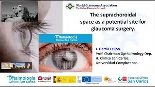 The suprachoroidal space as a potential site for glaucoma surgery