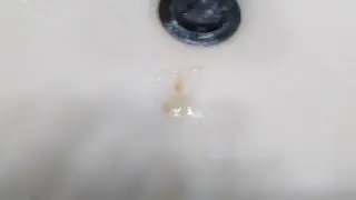 Coughing Up Brown Mucus In The Sink