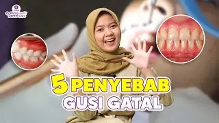SPILL HOW TO CURE ITCHY GUMS