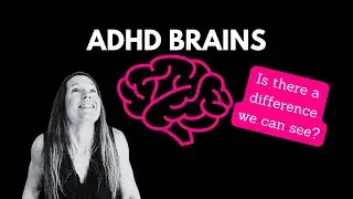 What's Special about ADHD Brains?